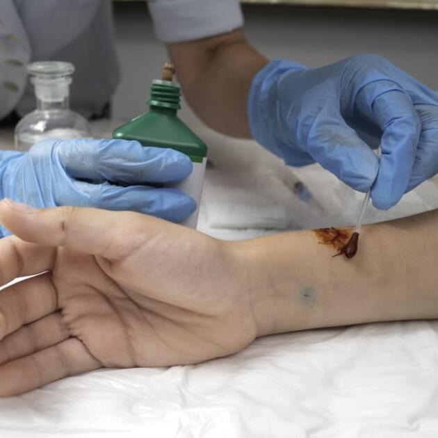 Formation Stop the Bleed